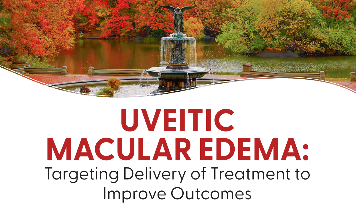 Uveitic Macular Edema: Targeting Delivery of Treatment to Improve Outcomes
